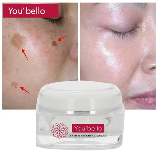 You' Bello Skin Whitening Cream - 30g - Himalayan Beauty