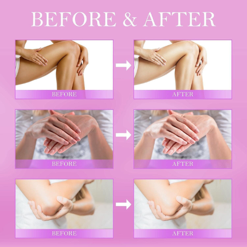 Before and after comparison of skin treatment on hands and legs with a pink background.