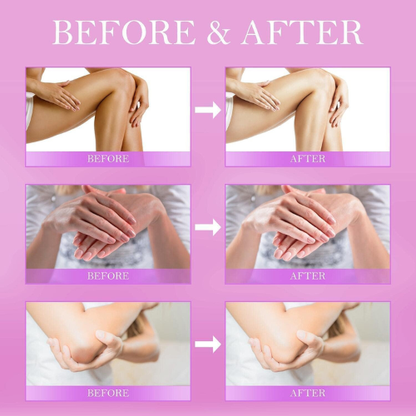 Before and after comparison of skin treatment on hands and legs with a pink background.